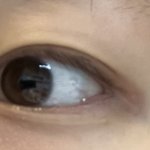 [댓글부탁해] 눈가 <b>착색</b> 어찌함 제발