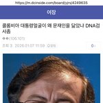 [군대] 스트레스성 <b>탈모</b>?