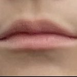 나 입술 주변이 하얀데 이거 입술 <b>필러</b>로