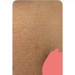 피부 이<b>난리</b>인데 뭐가 문젤까