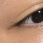 [댓글부탁해] 피부 다좋은데 <b>기미</b>때문에 미치겠음