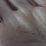 고정식 유지<b>장치</b> 떨어졌는지 봐주라