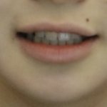 왜 <b>교정</b>한 애들은