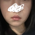 71키로<b>일때</b>도 얼굴만보면 괜찮았어서 심각성 모르고