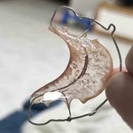 [어케생각해] 유지장치 진짜 싫다 진심 <b>개토</b>할거같음