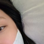 사랑니 뺀 스테이씨 수민