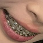 [드루와] <b>교정</b>한 애들아