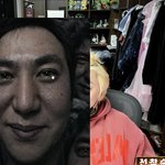 턱보톡스 맞아본 띠<b>니</b>들 들어오시긔