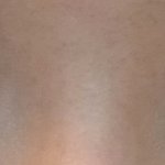 <b>쌍수</b>할까말까