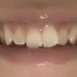 <b>이빨</b> 갈고싶다