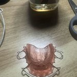 [댓글부탁해] 교정 끝나고 하는 유지<b>장치</b>