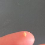 <b>치실</b>은 진짜 신이다