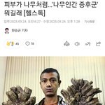 [하고싶은말] <b>피부</b>