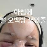 <b>랄랄</b>, 눈밑지·코 수술 후 멍 투성이"벌 500방 쏘인 줄"