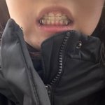 [댓글부탁해] 쌰갈 유지<b>장치</b>가 너무 거지같은데