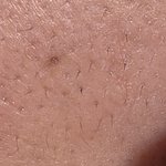 볼에 이런 <b>털들</b> 나만 있어..?