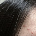 [어케생각해] 나 <b>여드름</b> ㅈㄴ대각선으로 생김 하