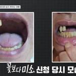 [어케생각해] 매주 3000만원씩 재능기부 뿌리는 부모님 임플란트...