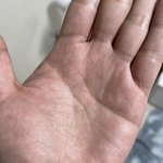 유명브랜드 소세지 먹다가 혓바닥에 철심이 박혔습니다.