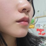 나두 열꽃이 펴성