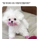 코로나 백신 맞고 심장에 <b>통증</b> 생겼어요