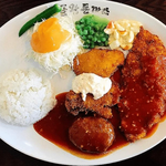 [이런일이] 역류성 식도염 걸리면 끊어야하는 음식