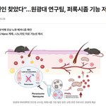 진짜 <b>탈모</b>가 해결되긴 할까???