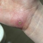 [댓글부탁해] 혐? 이거 뭔 <b>상처</b>같음