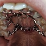 [댓글부탁해] 교정해서 <b>발음</b> 이상한 사람이랑 연애 ㄱㄴ??