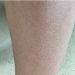 [이것좀봐줘] 내가 치마를 ㅈㄴ 싫어하는 이유