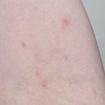 나보다 피부 <b>예민</b>한사람 있냐