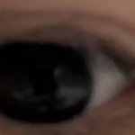<b>렌즈</b> 안꼈는데 동공 작아??