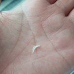 비비고 <b>왕만두</b>에서 이상한 거 나왔는데