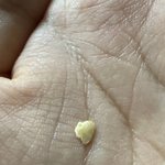 버거먹다 이물질 나왔는데