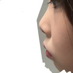 [댓글부탁해] <b>코성형</b> 상담좀여!!