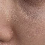 (약혐주의)이런피부 대체 어떻게해야돼..? 도와줘