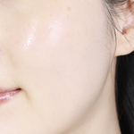 [드루와] 날씨가 더워지면 여드름나는 이유