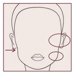 [시술] 3년만에 땅콩형얼굴 탈출한 썰.jpg