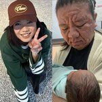 피부질환사진주의) 아니 임신 ㅈㄴ 무섭네