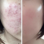 이너 뷰티 먹고 안먹고의 차이