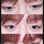 박지훈같은눈 <b>성형</b>으로가능함?