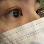 쌍수 붓기 좀 남아있을 때로 돌아가고싶음..