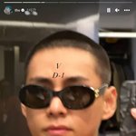 [드루와] 모발이식 왜 하는 거임,,,?