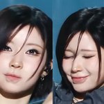 이거 입술 <b>필러</b> 부작용임...?