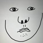 [댓글부탁해] 인중 늘리는 수술은 없음?