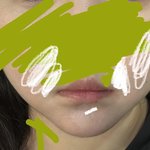 입술 ㅈㄴ 옹졸한 느낌인데 <b>필러</b> 맞으면