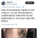 2주 이상 똥 못 싼 <b>사람의</b> 엑스레이래...