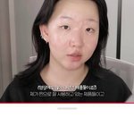 [이것좀봐줘] 여드름 피부 유튜버가 효과 봤다는 스킨케어템