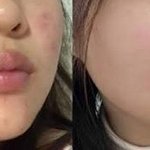 이너뷰티 솔직히 효과없을줄 알았는데;;