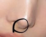 나 <b>코</b>성형 해야되는데 망설이게 되는 이유가